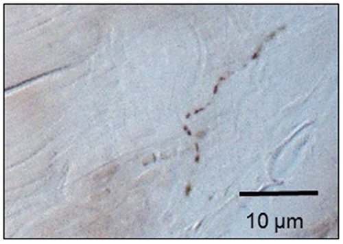 Innervation Of The Thoracolumbar Fascia European Journal Of Translational Myology